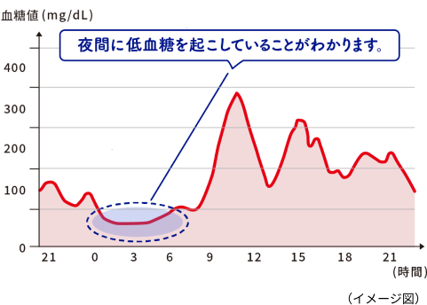 夜間に血糖変動を起こしていることがわかります。